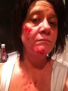 Blood seen on woman after quake strikes